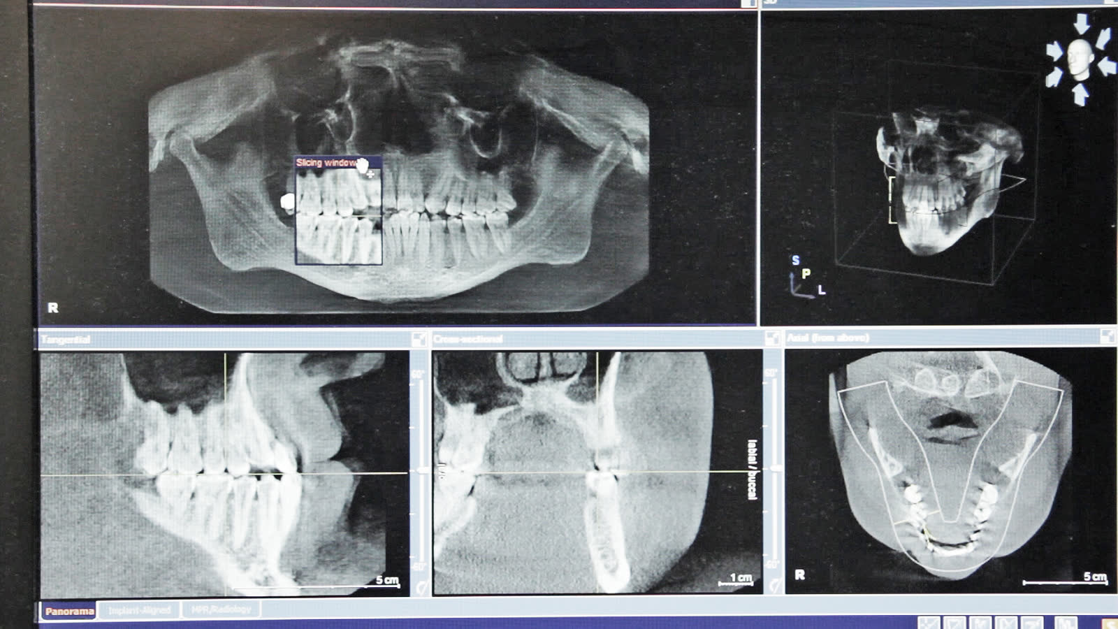 585 Dentist CT Scan